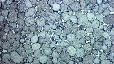 Heavy Metal on a Tungsten Basis with High Radiation Absorption Capacity Offers an Ecological Alternative to Toxic Lead