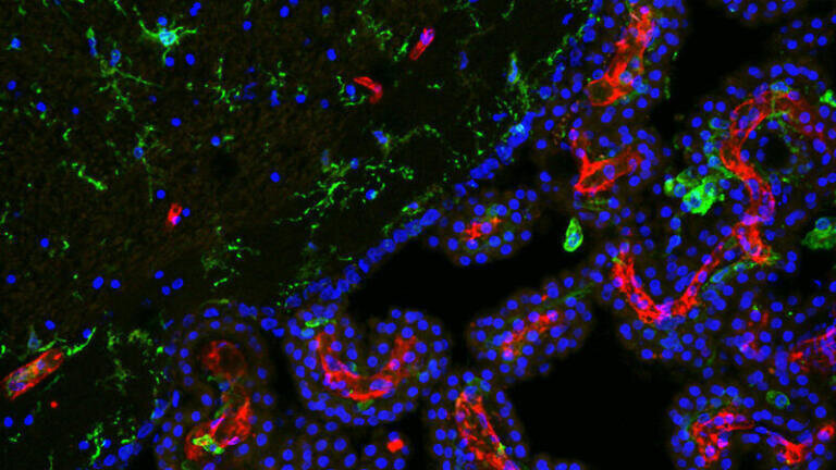 Light Microscopy - Life Sciences
2nd Prize:
Border Patrol.
Inside the brain ventricles, the choroid plexus (right corner)<br>represents the barrier between the body immune system (Macrophages, green round cells) and the brain-specific counterpart (Microglia, green ramified cells in left corner). Immunofluorescent image acquired via Leica laser scanning confocal microscope. Green:Iba1 (Immune cells) Red:Laminin (blood vessels) Blue:DAPI (cell nuclei). Image size: 0.5 x 0.5 mm.    
Roberto Fiorelli, Barrow Brain Tumor Research Center, Phoenix AZ (USA)

