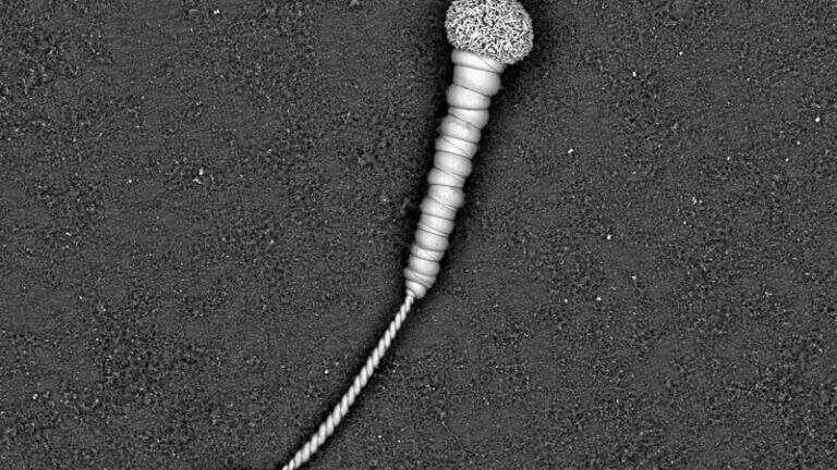 Electron Microscopy - Physical Sciences
2nd Prize:
Micronphone.
This biomimetic form is a self-assembled inorganic structure of barium carbonate that mimics life in fossil form. And at the same time reminds us an old micrometer-scale microphone. The image was acquired with a scanning electron microscope at 1kV in deceleration mode.
Lionel Cervera Gontard, University of Cádiz, Spain
