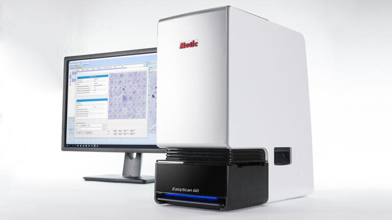 AI-Powered Microscope to Fight Drug-Resistant Malaria Introduced