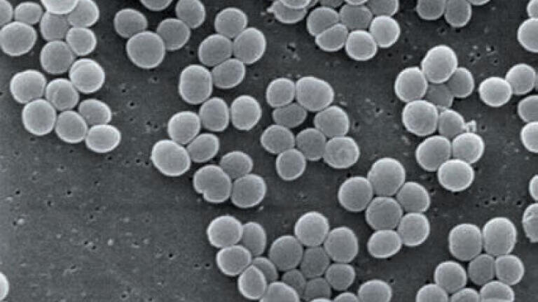 Nanoparticle Detection Technique to Combat MRSA