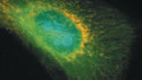 Nobel Prize Winning Filters