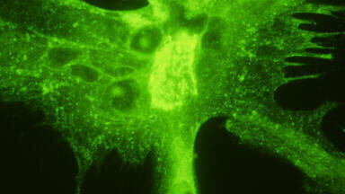New Herpes Virus Monoclonal Antibodies
