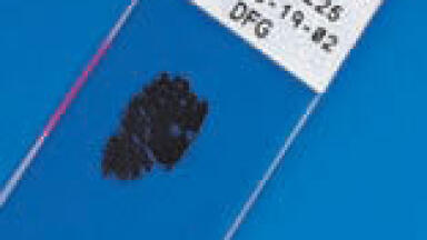 Permanent Labelling for Microscope Slides