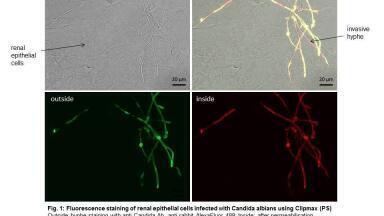 Fluorescence Staining of Renal Epithelial Cells Infected with Candida albicans using Clipmax