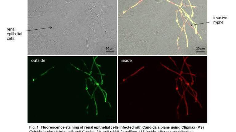 Fluorescence Staining of Renal Epithelial Cells Infected with Candida albicans using Clipmax