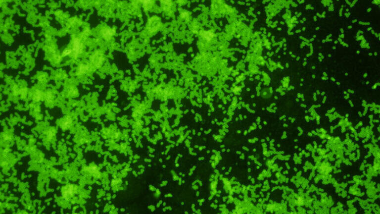 New Rabbit Monoclonal Antibody to Group B Streptococcus