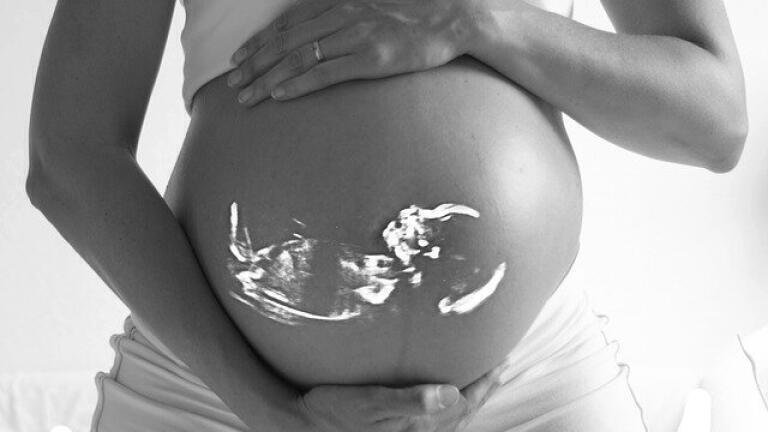 Can Ultrasounds Cause Autism?