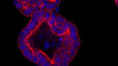 Highest Stability Recombinant Wnt3a for Organoid Culture