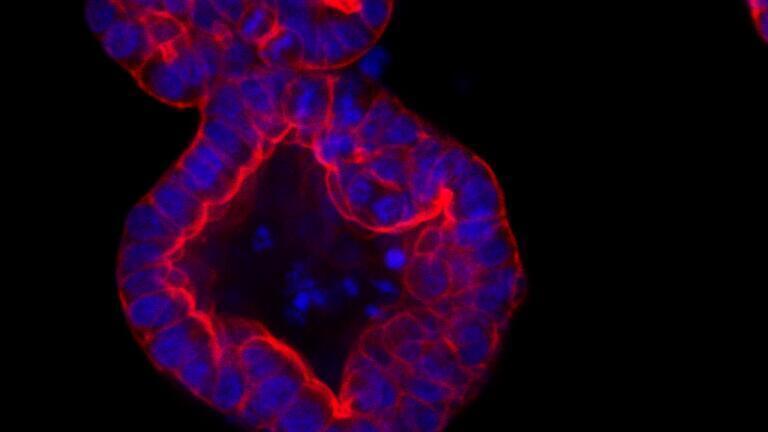 Highest Stability Recombinant Wnt3a for Organoid Culture