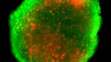 Novel Microfluidic Platform for Cancer Research