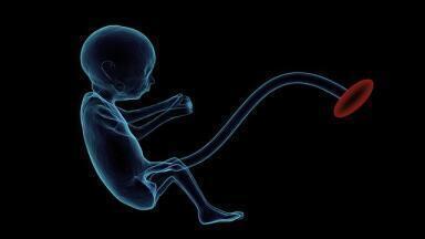 What is Umbilical Cord Blood Banking?