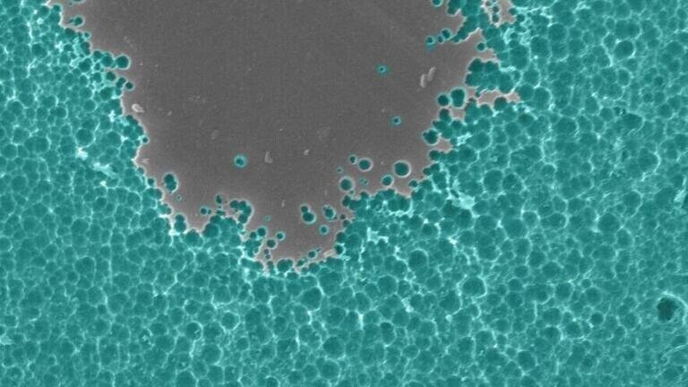 EM photos of enzyme/substate interactions. pic credit Dennis Schroeder/NREL