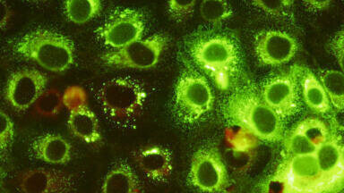 New Japanese Encephalitis Virus Monoclonal Antibodies