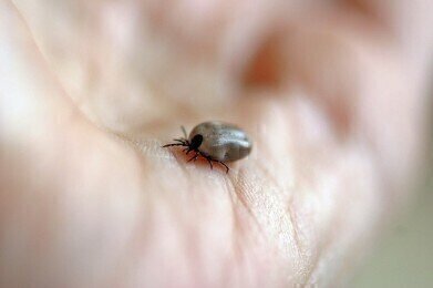 Why Are Tick-Borne Diseases on the Rise?
