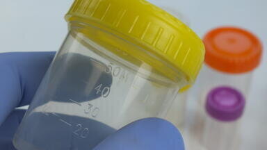 Everyday Security for your Samples with EveryDay Specimen Containers