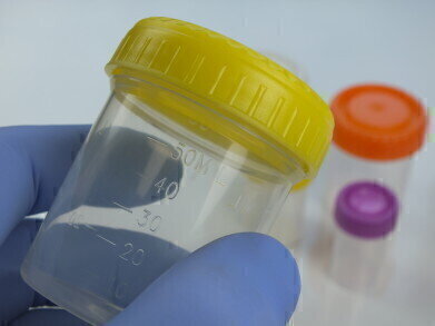 Everyday Security for your Samples with EveryDay Specimen Containers