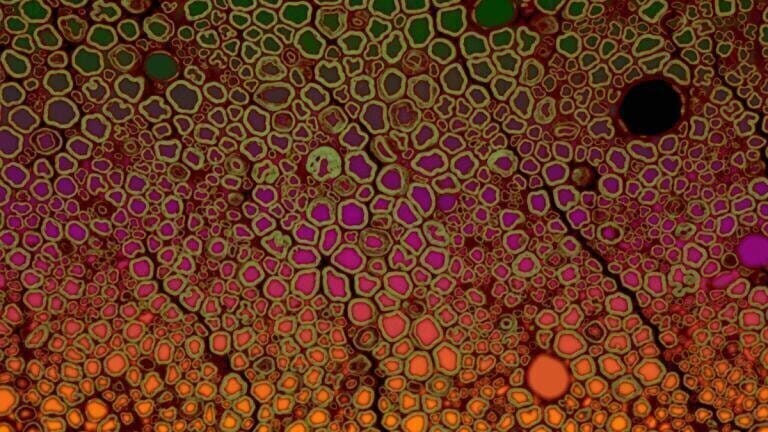 Bob Asselbergh- fluorescent image of a scietic mouse nerve