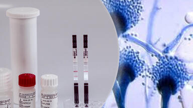 Simplify Diagnosis of Invasive Aspergillosis