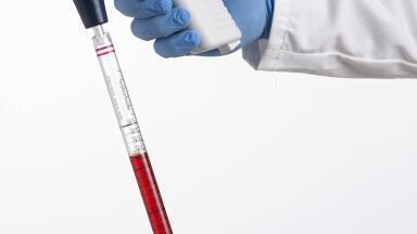 Compact Electronic Pipette Filler Perfect for Fumehood Use