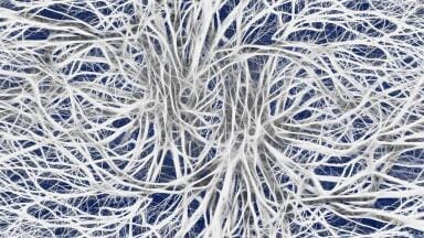 Can Progressive MS Be Slowed Down?