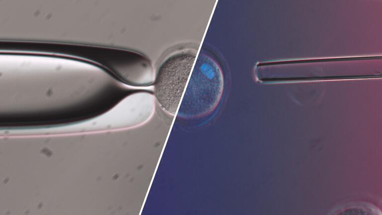 Improve success rates with Olympus IVF Solutions