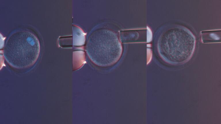 Improve success rates with Olympus IVF Solutions