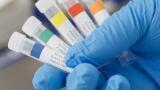 Identify samples by colour to increase productivity