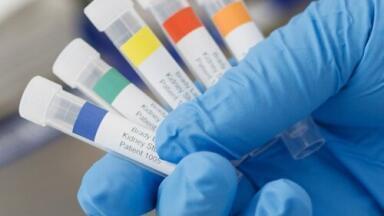 Identify samples by colour to increase productivity