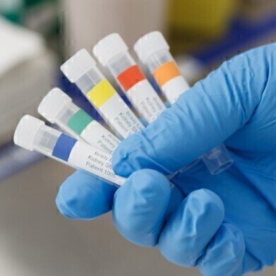 Identify samples by colour to increase productivity