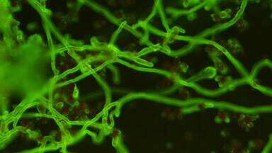 New Aspergillus Monoclonal Antibody