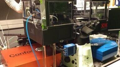 New Super Resolution Confocal Imaging System at ScopeM Announced
