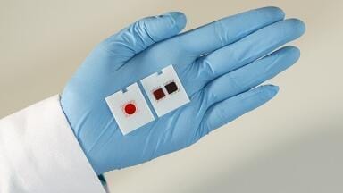 Slides that Run 2 Diagnostics Tests Simultaneously Awarded CE Mark