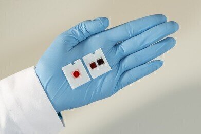Slides that Run 2 Diagnostics Tests Simultaneously Awarded CE Mark