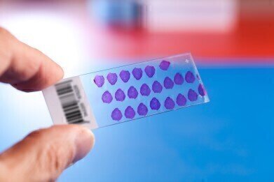 New Tissue Microarrays Conform with FDA Standards