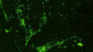 New Monoclonal Antibodies to Mycobacteria