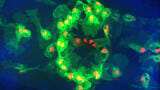Apoptosis Process Found to Disrupt Immune Cell Function