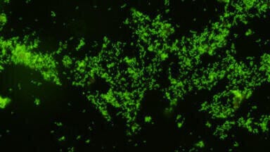 New Set of Monoclonal Antibodies to Gardnerella vaginalis Released