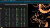 Structural Data Platform to help Advance Treatments for Brain Disease