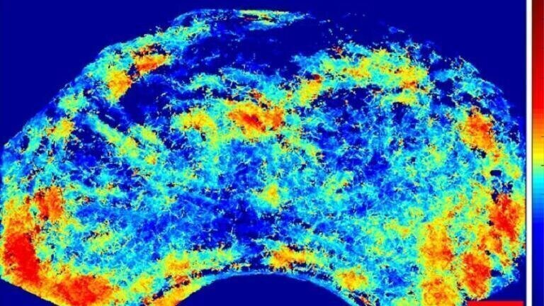 Enhanced image using microbubble technique.
(Credit: Heriot-Watt University)
