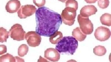 Digital Pathology is First to Develop Rapid Oil-immersion Slide Scanner