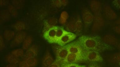 New Monoclonal Antibodies to Coronavirus Released