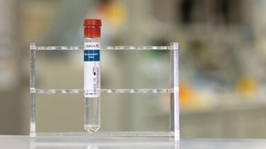 New Blood Collection Tubes Maintain Sample Integrity for up to 7 Days