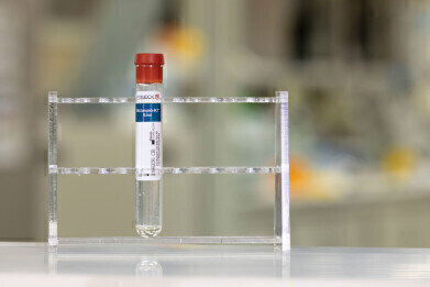 New Blood Collection Tubes Maintain Sample Integrity for up to 7 Days