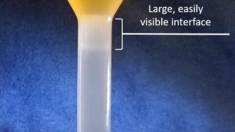 New Kit Enables Efficient Isolation of Highly Purified Peripheral Blood Mononuclear Cells
