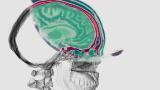 Earth Imaging Technique transforms into Detailed Brain Imaging Technology