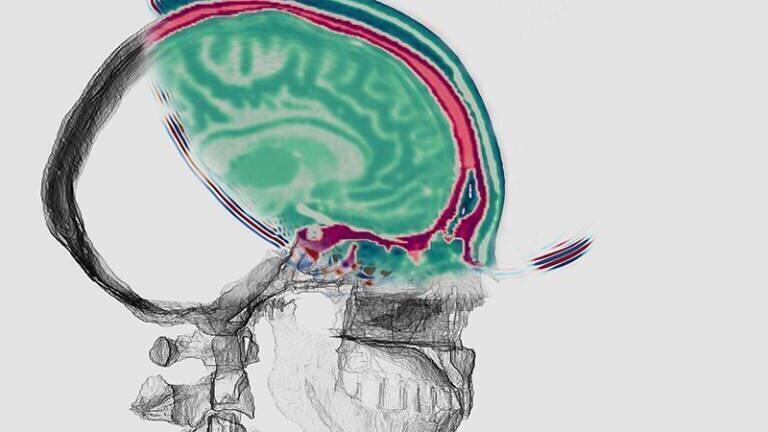 Earth Imaging Technique transforms into Detailed Brain Imaging Technology