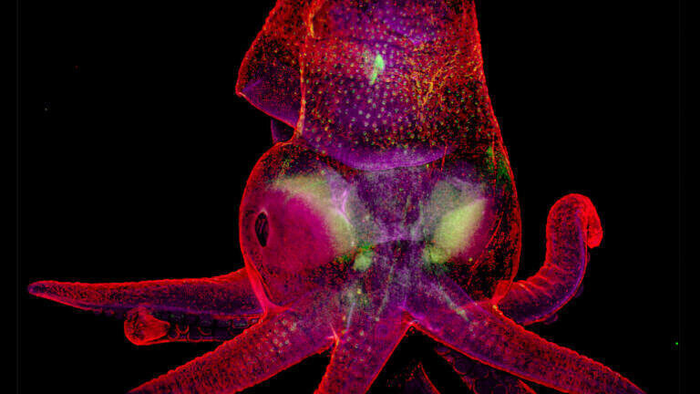 mmc2019 1st Place Light Microscopy-Life Sciences. Martyna Lukoseviciute, University of Oxford, Weatherall Institute of Molecular Medicine: Understanding the Octopus Embryo (Credit RMS)