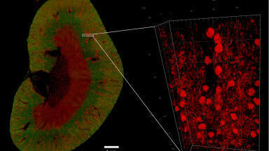 New Light Sheet Fluorescence Microscope Introduced