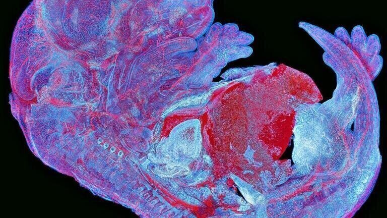 Asia-Pacific regional winner Howard Vindin – autofluorescence image of mouse embryo